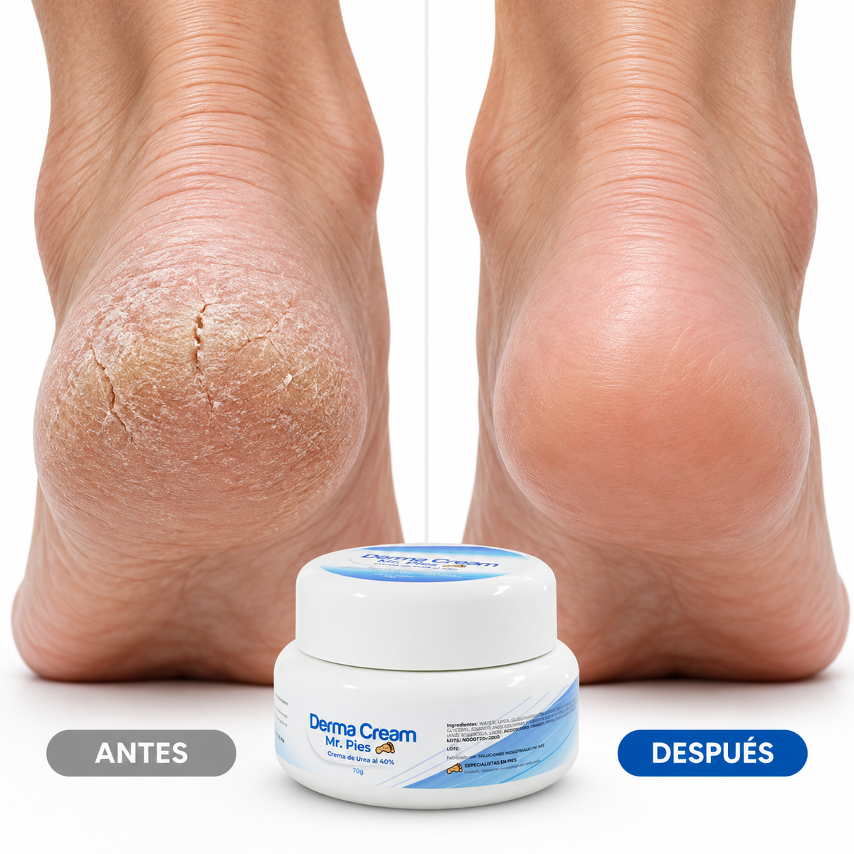 Derma Cream - Mr Pies